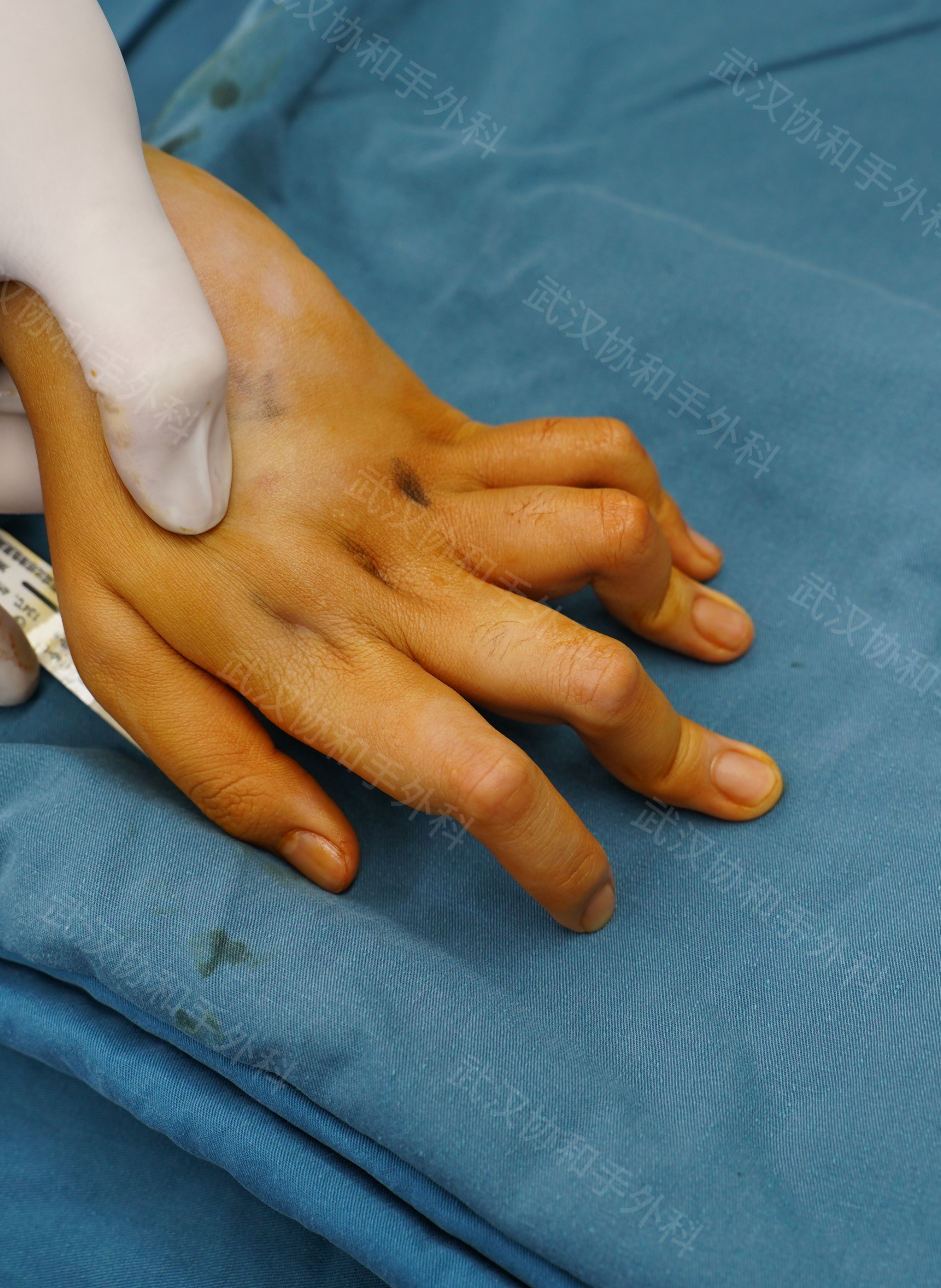 包含亚眠球员遭遇伤病困扰未来发展蒙阴影的词条